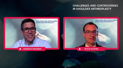 Kinematics and Biomechanics of Shoulder Arthroplasty – thumbnail 1 of 8