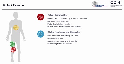 Meniscus Preservation in Degenerative Disorders – thumbnail 2 of 16