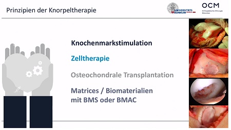 #214: Minced Cartilage mit Chondro-Gide – thumbnail 2 of 8