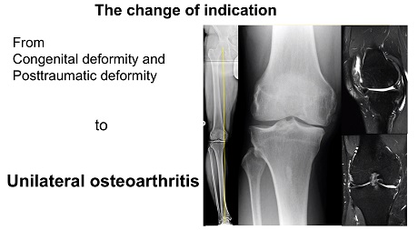 #255: Basics in Osteotomy around the Knee – thumbnail 2 of 10