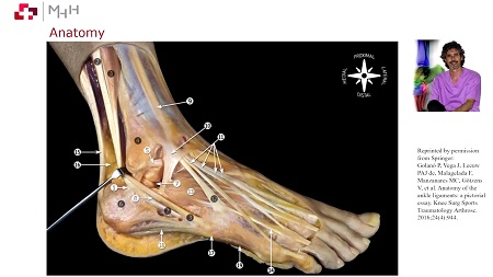 #274: Ankle Sprain – A Simple Story? (Session 1) – thumbnail 2 of 9