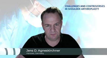 Periprosthetic Joint Infection in Shoulder Arthroplasty – thumbnail 3 of 6