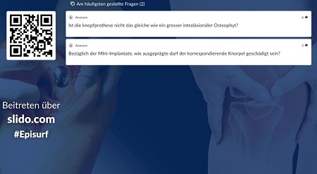 #195: Behandlung von chondralen und osteochondralen Schäden am Kniegelenk (Part 1) – thumbnail 4 of 4