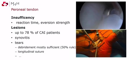 #505: Ankle Sprain – A Simple Story? (Session 2) – thumbnail 6 of 9