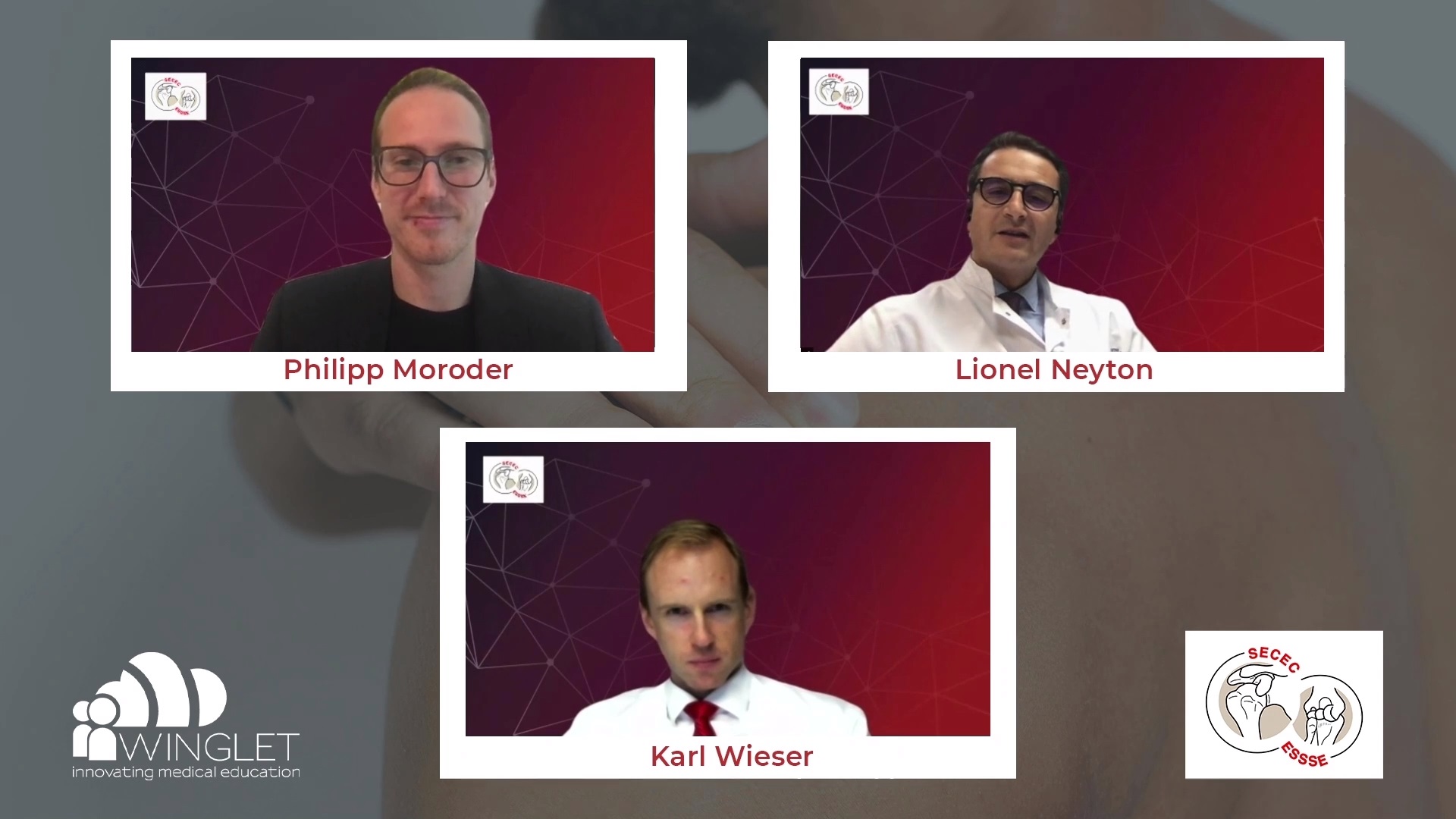 #1811: Static Posterior Glenohumeral Subluxation without Arthritis – thumbnail 6 of 6