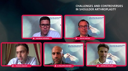 Kinematics and Biomechanics of Shoulder Arthroplasty – thumbnail 7 of 8