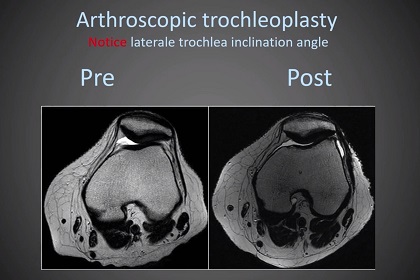 #246: Patellofemoral Pain and Arthritis – thumbnail 7 of 9
