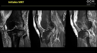 AGAnywhere Monthly - #005: Periphere Instabilitäten des Kniegelenkes – thumbnail 8 of 12