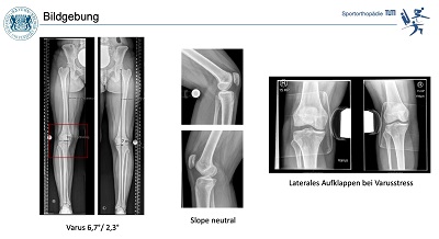 AGAnywhere Monthly - #005: Periphere Instabilitäten des Kniegelenkes – thumbnail 10 of 12