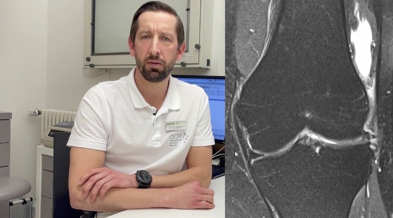 FKT@Home 2022 (Day 2) - Treatment of Cartilage Defects in the Knee – thumbnail 10 of 11