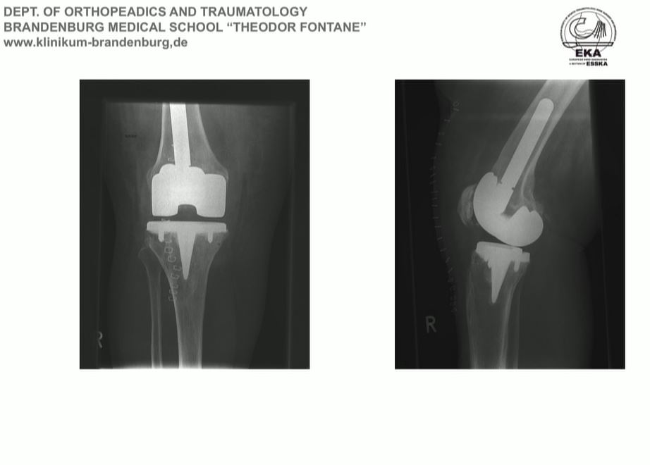 #506: Knee International I – thumbnail 9 of 10