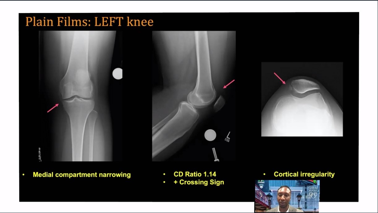 Across the Atlantic: American and European Insights on Patellar Instability – thumbnail 10 of 14