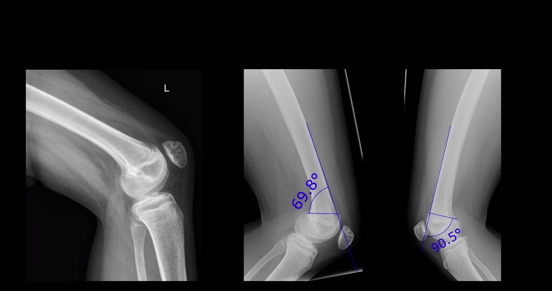 AGAnywhere Monthly - #022: Die patellofemorale Instabilität – thumbnail 10 of 12