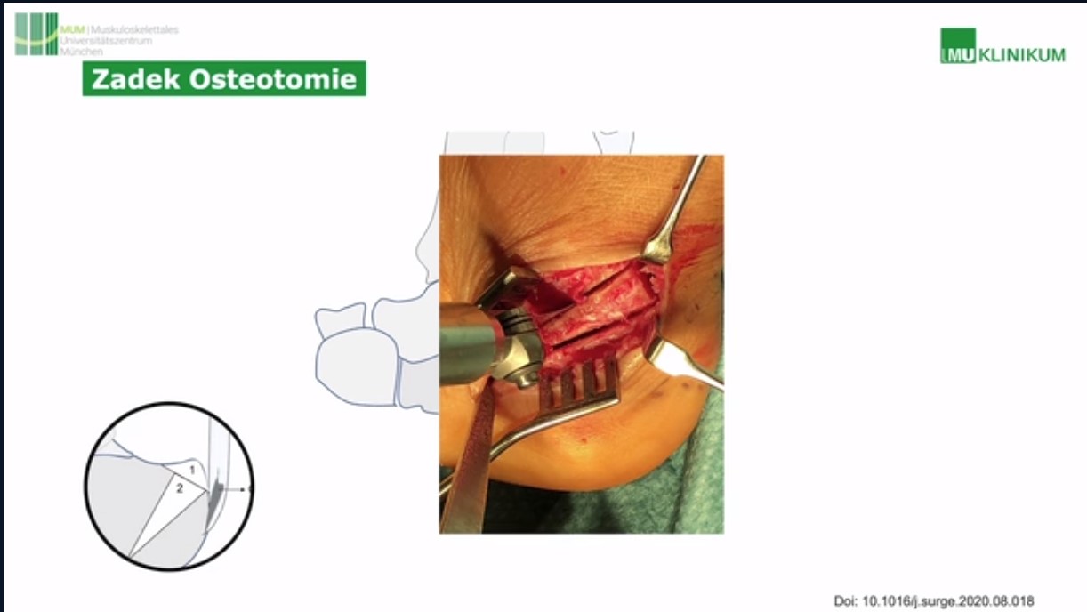 AGAnywhere Monthly - #024: Sehnen rund um das obere Sprunggelenk – thumbnail 10 of 12