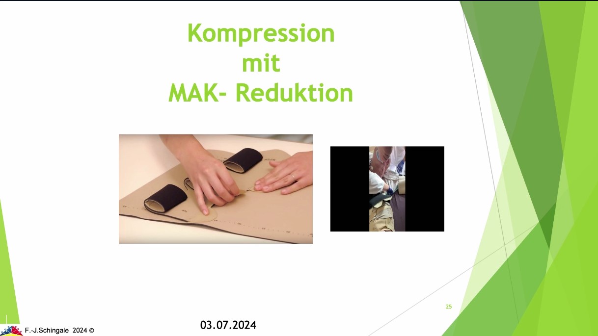 #307: Faszination Lymphologie: Lymphödem & Lipödem – thumbnail 10 of 12