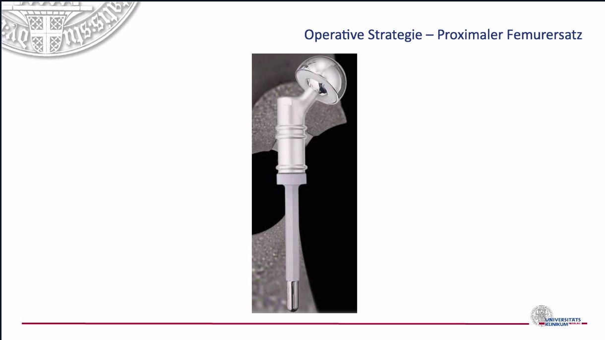 VSOU TV-Serie - Folge 2: Knochentumore – thumbnail 10 of 13