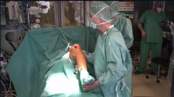 Orthopedic Film Festival 2023 – Recon, Trauma & Spine – thumbnail 10 of 17