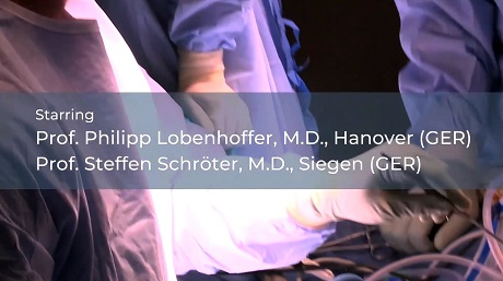 #255: Basics in Osteotomy around the Knee – thumbnail 10 of 10