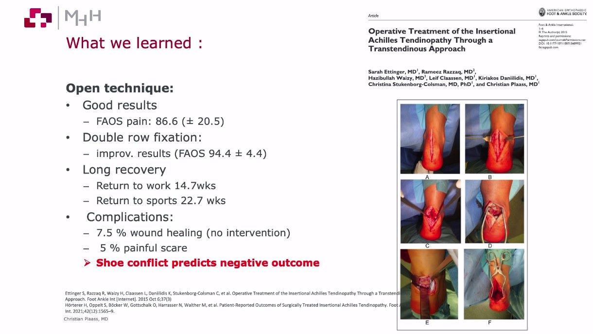 Winglet Originals #017: Degenerative Achilles Tendon Disease – thumbnail 10 of 14