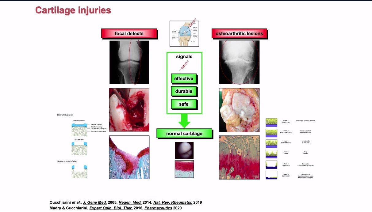 ICRS TV Series - #006: Cells, Signals & Scaffolds in Orthobiologics: How does it work? – thumbnail 10 of 15
