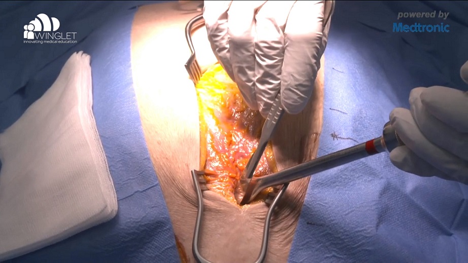 DKOU 2019 Wetlab - BioSkills Workshops & Live-Demonstrationen – thumbnail 10 of 10