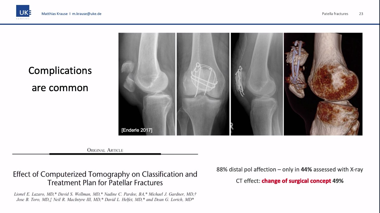 Winglet Originals #016: Patella Fractures – thumbnail 10 of 12