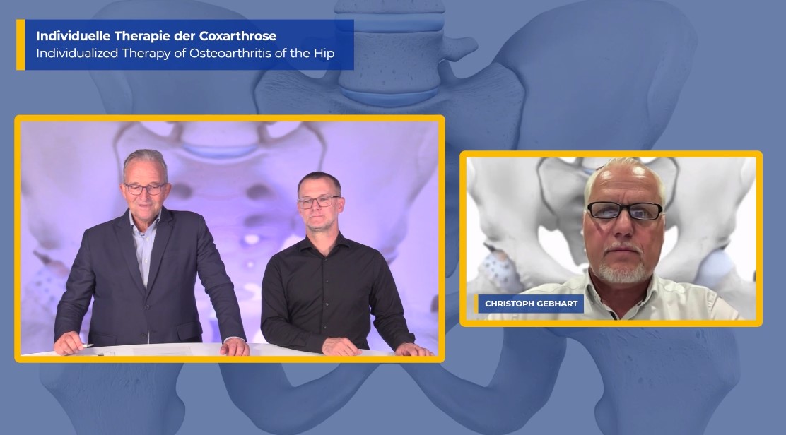 #235: Individualized Therapy of Osteoarthritis of the Hip – thumbnail 10 of 10