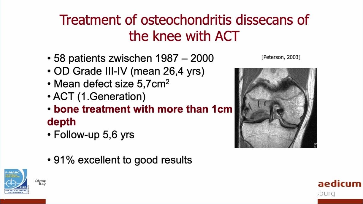 ICRS TV Series - #008: Chondrocyte and Fragmented Cartilage: Products and Procedures – thumbnail 10 of 12
