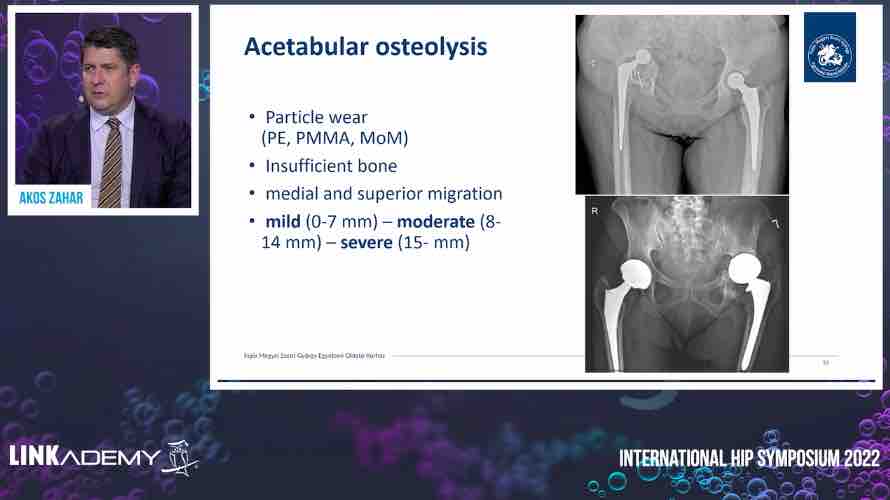 LINKademy International Hip Symposium – thumbnail 11 of 16