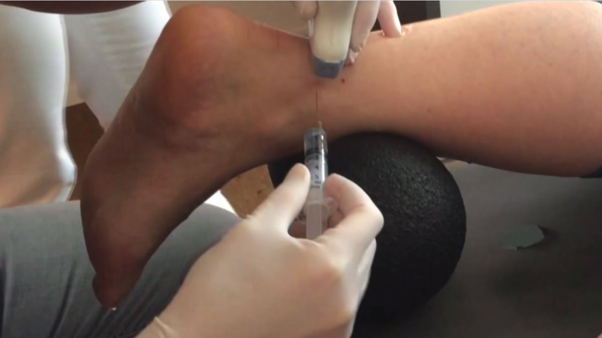 #174: Für die Praxis - Muskel- und Sehnenverletzungen – thumbnail 10 of 13