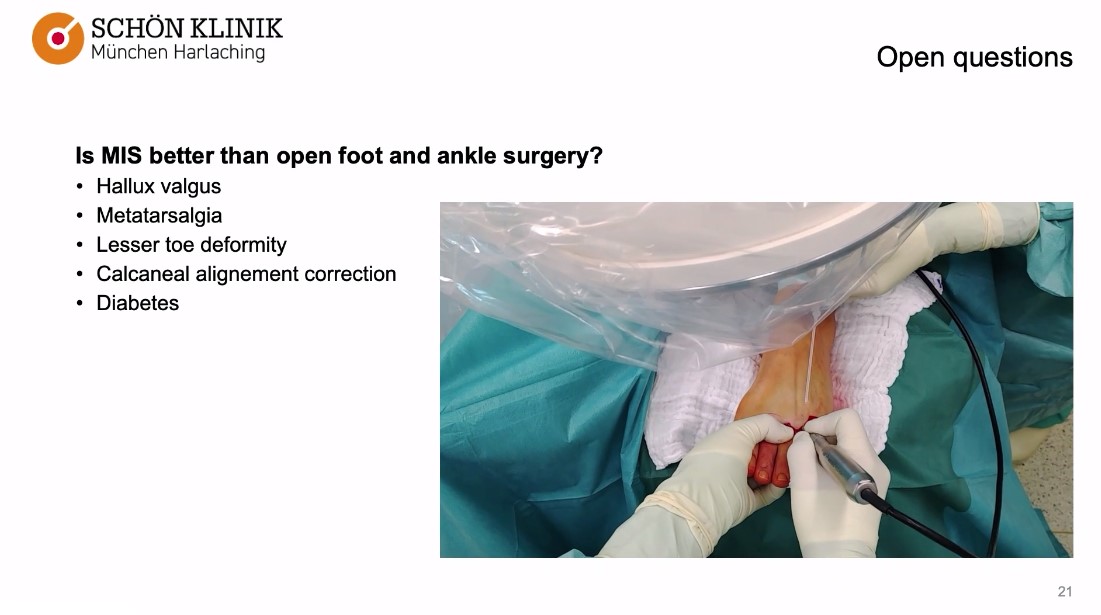 Winglet Originals #013: Minimally Invasive Foot Surgery – thumbnail 11 of 13