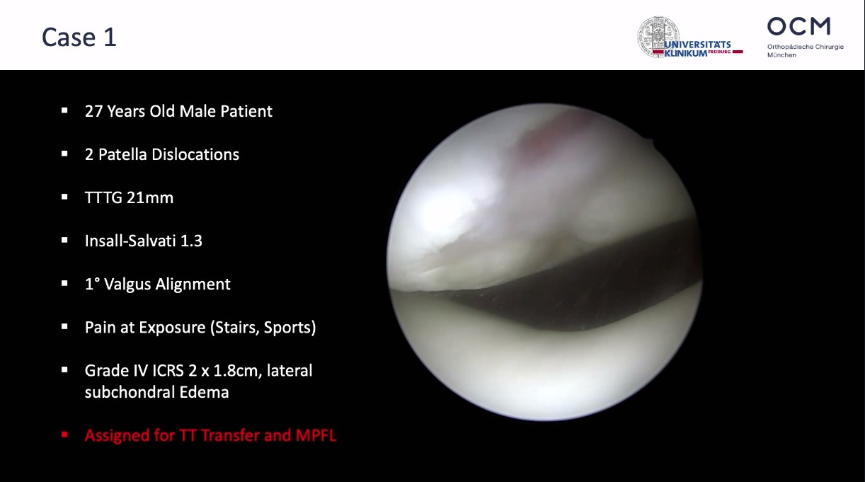 Across the Atlantic: American and European Insights on Patellar Instability – thumbnail 12 of 14