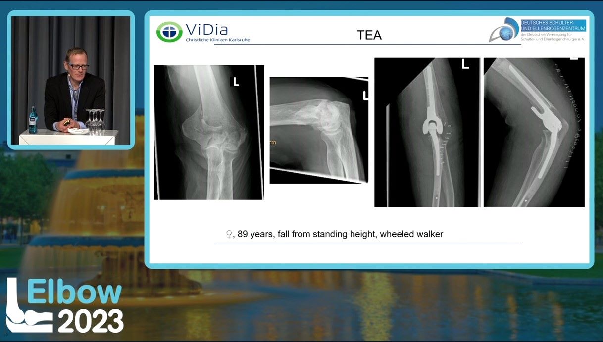 Elbow 2023 – thumbnail 30 of 38