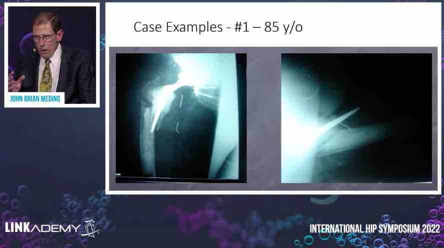 LINKademy International Hip Symposium – thumbnail 13 of 16