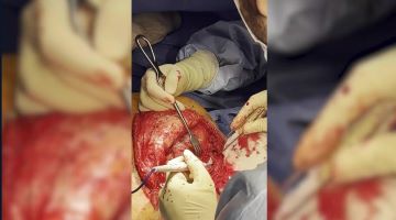 Orthopedic Film Festival 2023 – Upper Extremity & Sports – thumbnail 14 of 16