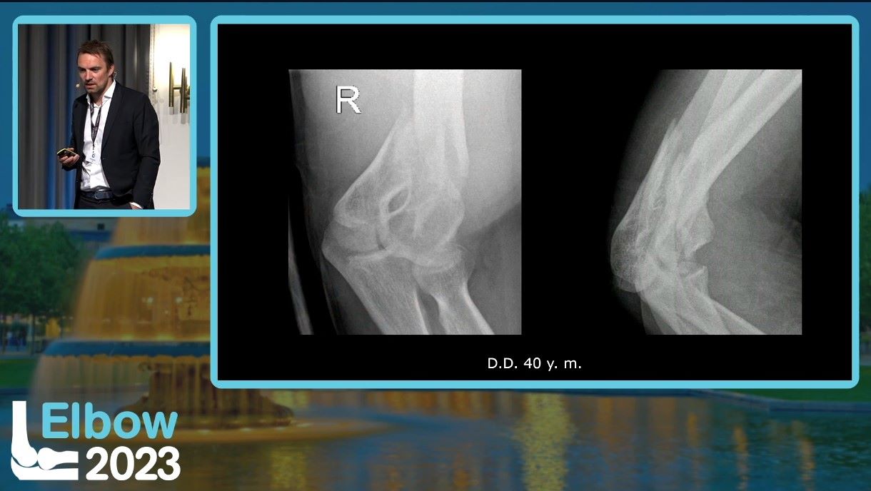 Elbow 2023 – thumbnail 32 of 38