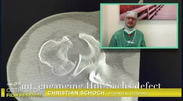 Orthopedic Film Festival 2023 – Recon, Trauma & Spine – thumbnail 14 of 17