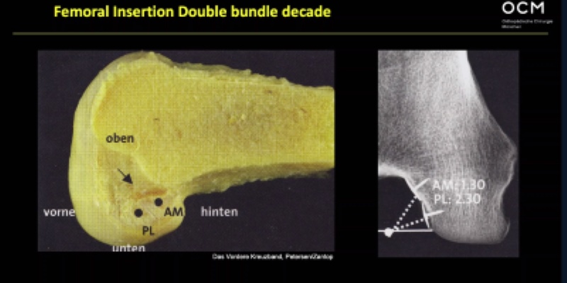 Winglet Originals #014: Basics in Knee Arthroscopy – thumbnail 14 of 19
