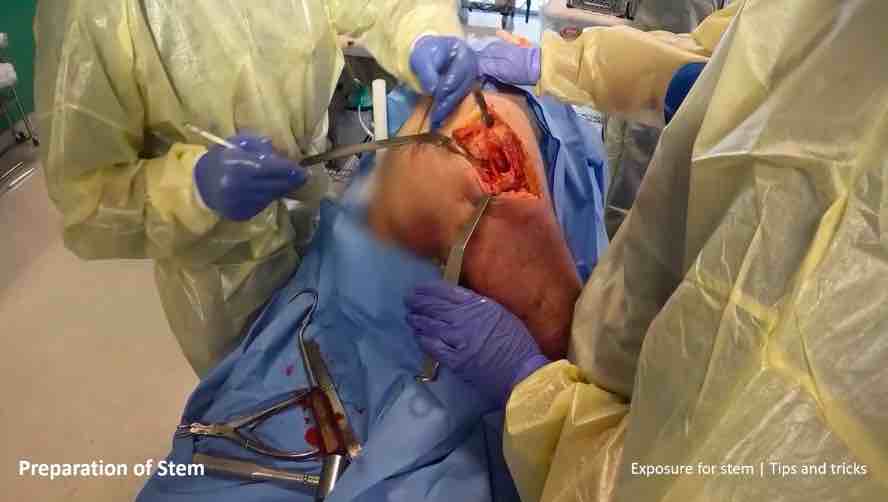LINKademy International Hip Symposium – thumbnail 14 of 16