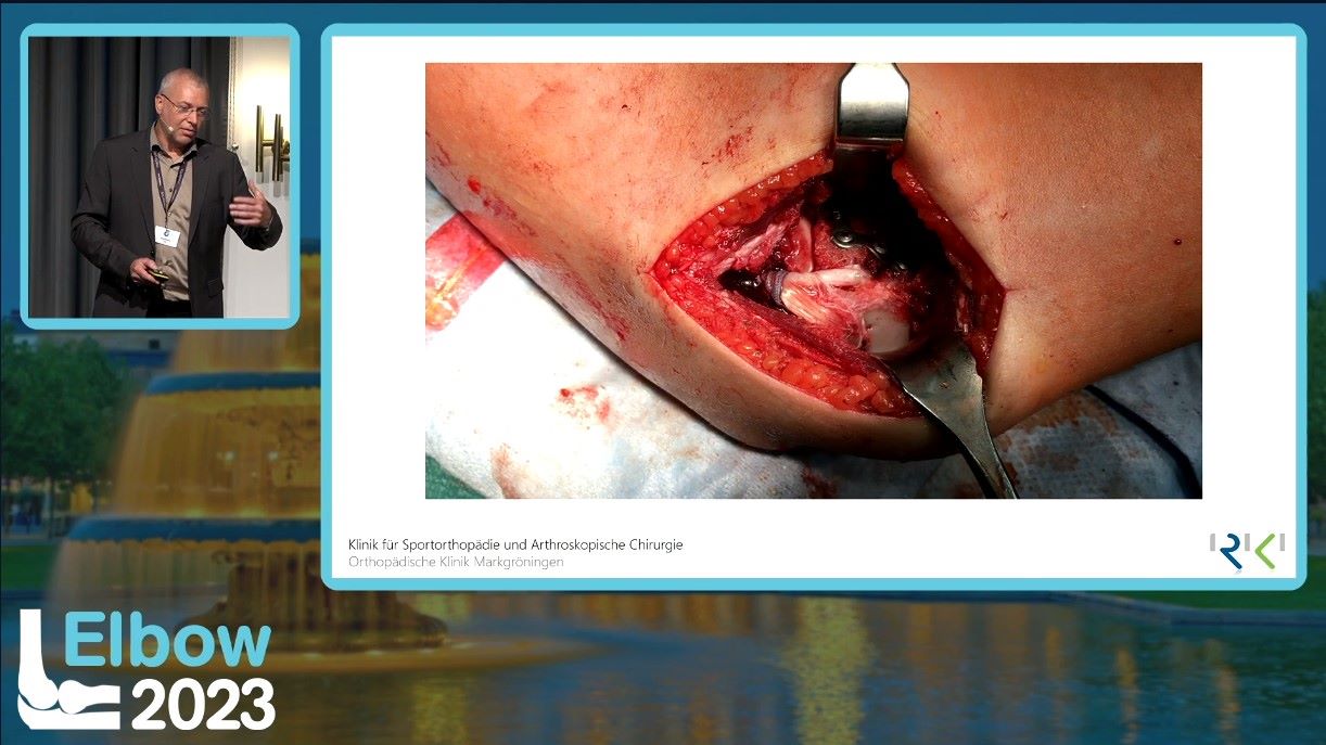Elbow 2023 – thumbnail 17 of 38