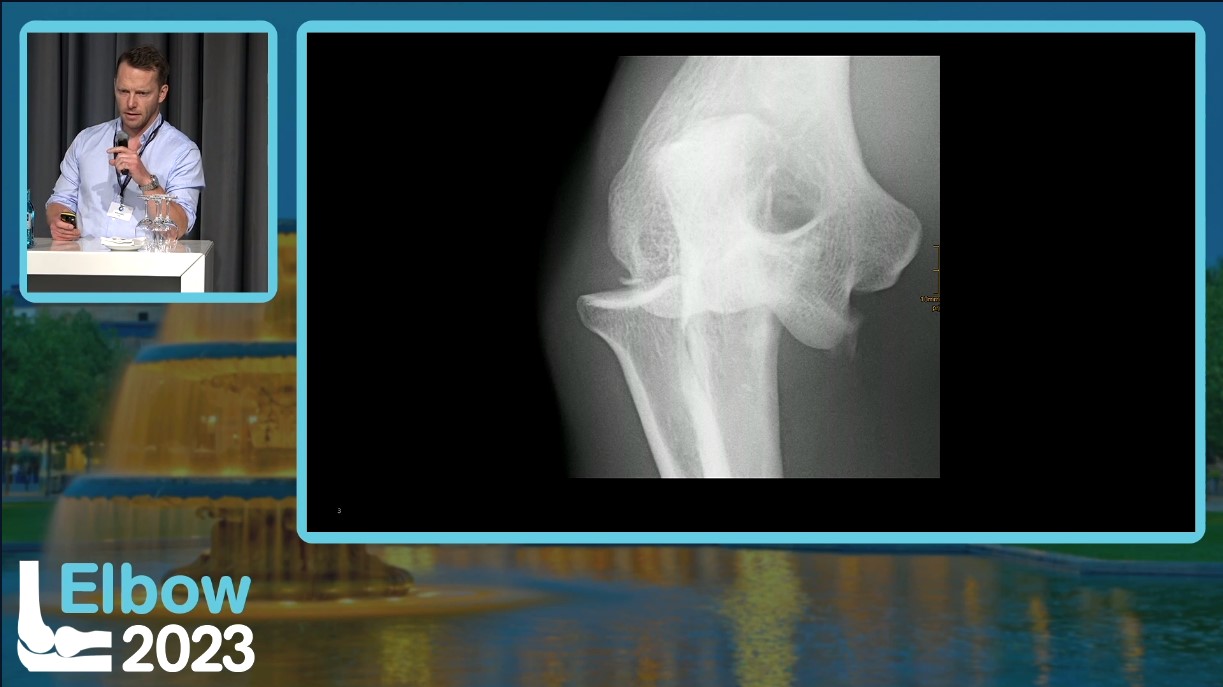 Elbow 2023 – thumbnail 35 of 38