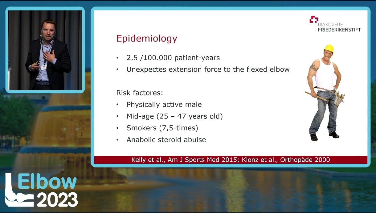 Elbow 2023 – thumbnail 1 of 38
