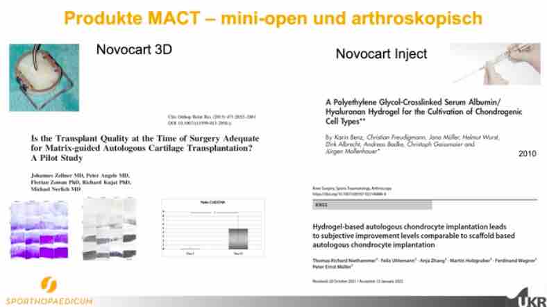 #704: Knorpelzelltransplantation mit Novocart® in der täglichen Praxis – thumbnail 1 of 10