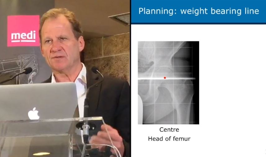 15th medi European Sports Orthopaedics Symposium – thumbnail 1 of 4