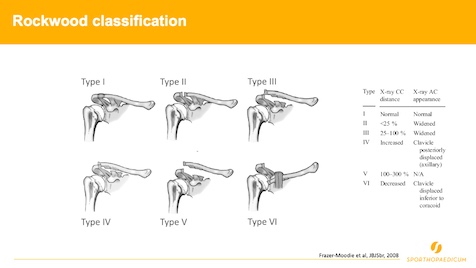 Winglet Originals #003: Acute and Chronic Pathologies of the AC Joint – thumbnail 1 of 11