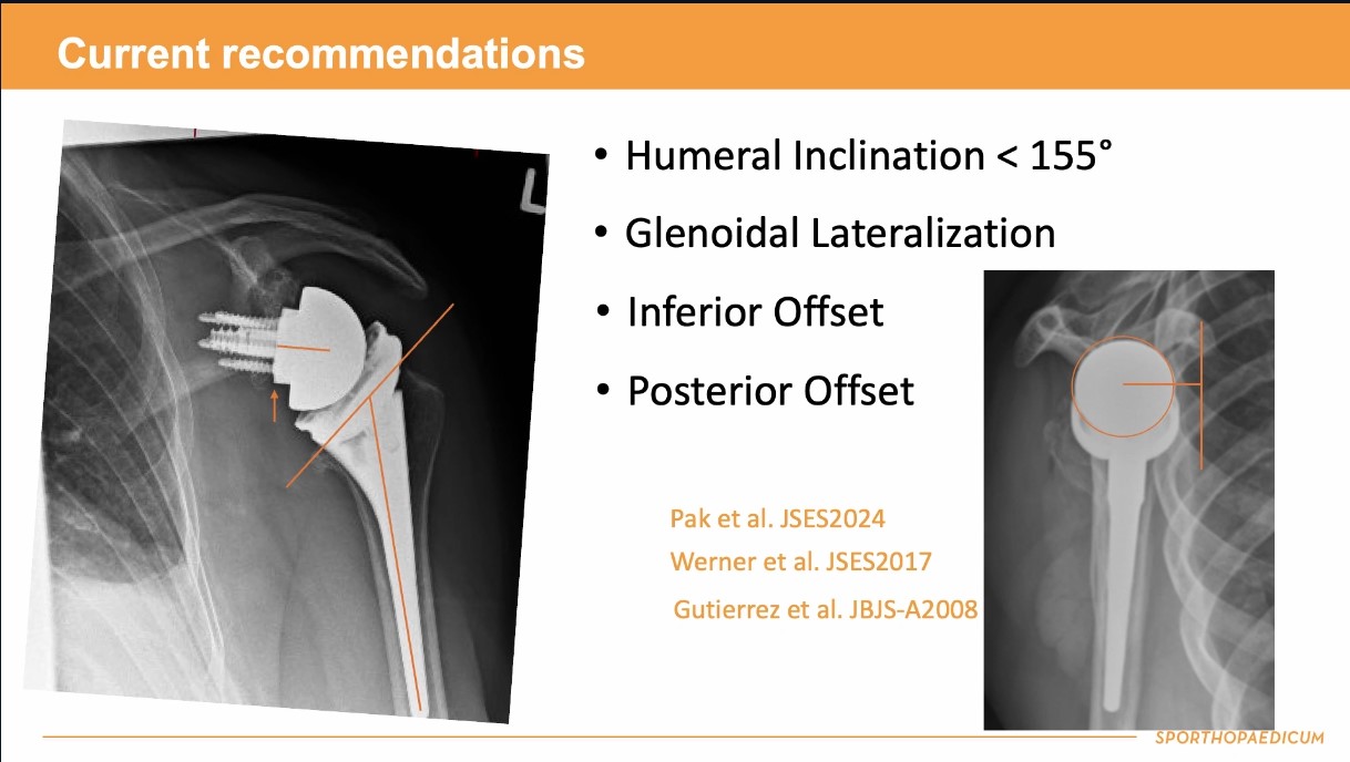 Winglet Originals #023: Planning & Augmented Reality in Shoulder Surgery – thumbnail 2 of 11
