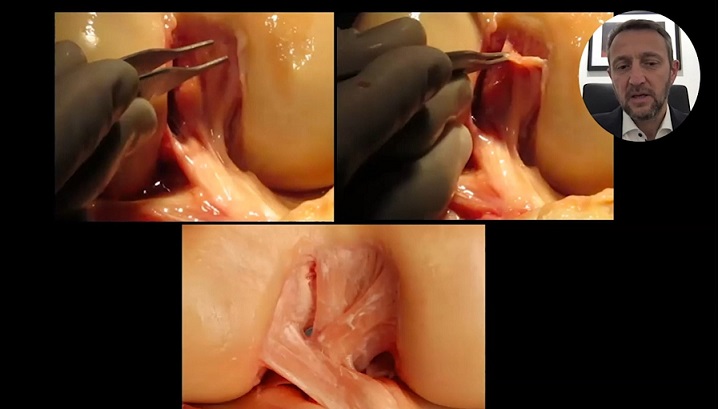 #173: Anatomy and Biomechanics of the Knee – thumbnail 2 of 8