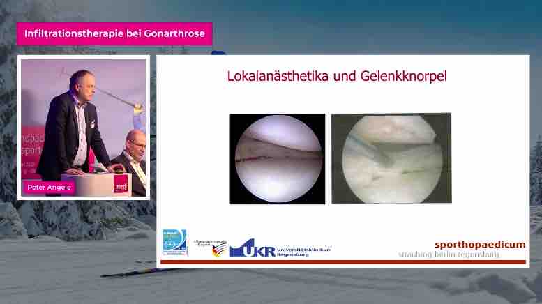 #271: Infiltrationstherapie bei Gonarthrose – thumbnail 2 of 7
