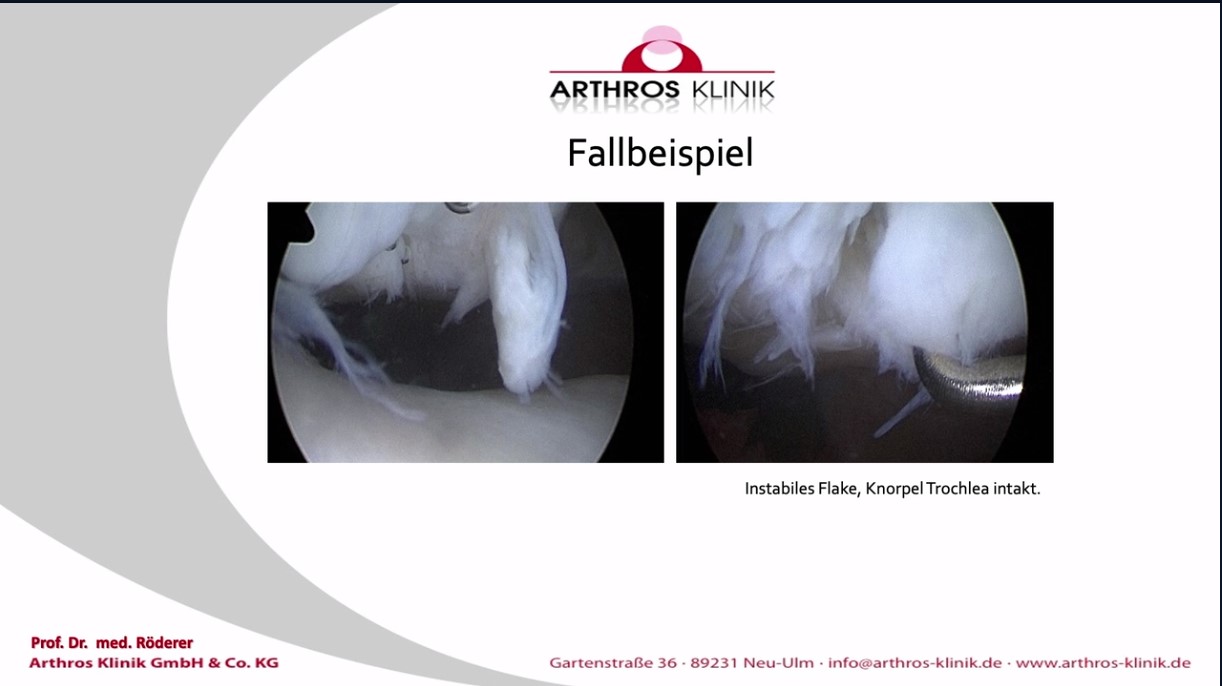 #1112: Status Quo ambulante ACT - Was hat sich in einem Jahr getan? – thumbnail 2 of 7