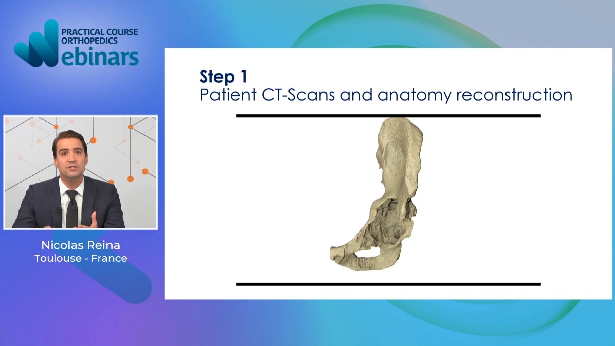 #295: Custom Implants for Acetabular Reconstruction – thumbnail 2 of 6